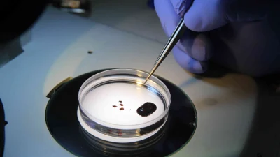 Prof. Dr. Adem Keskin, arazi sonrası vücut kene kontrolünün hayati