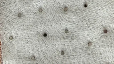 Elazığ’da yemek borusunu tıkayan 19 mıknatısı yutan 3 yaşındaki çocuk,