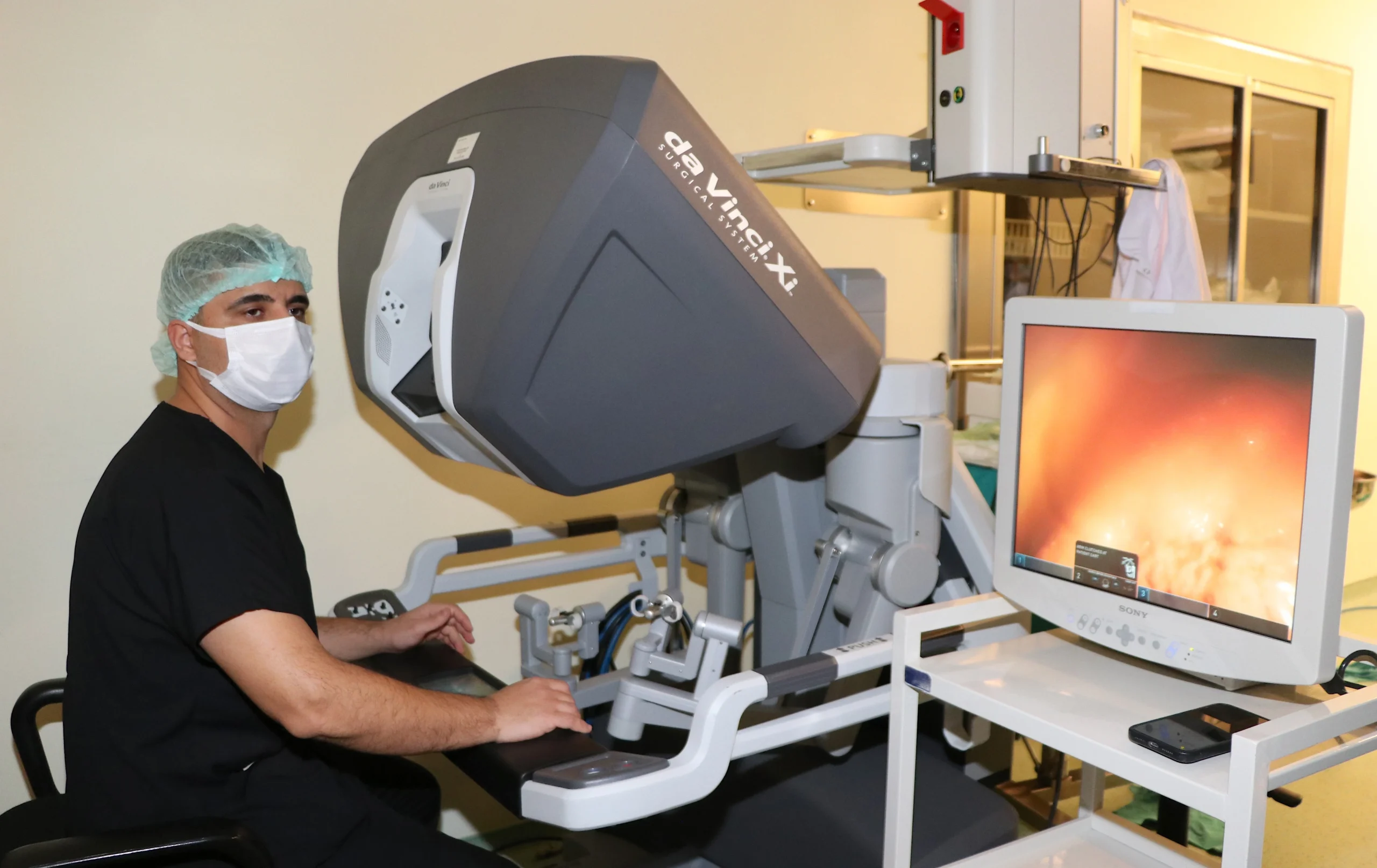 Erzurum Şehir Hastanesi’nde, robotik cerrahi teknolojisi kullanılarak ilk kez göğüs